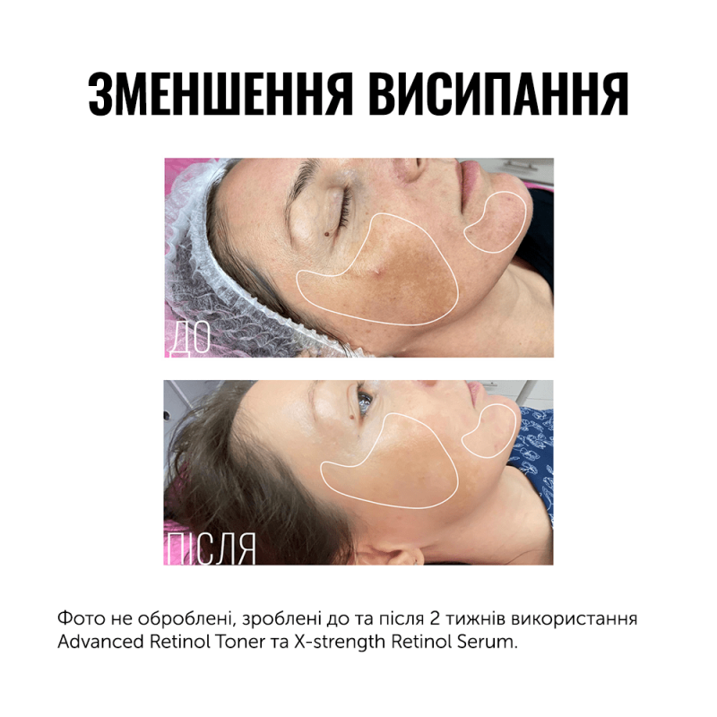 INSTYTUTUM Advanced Retinol Toner Travel Size 50 мл